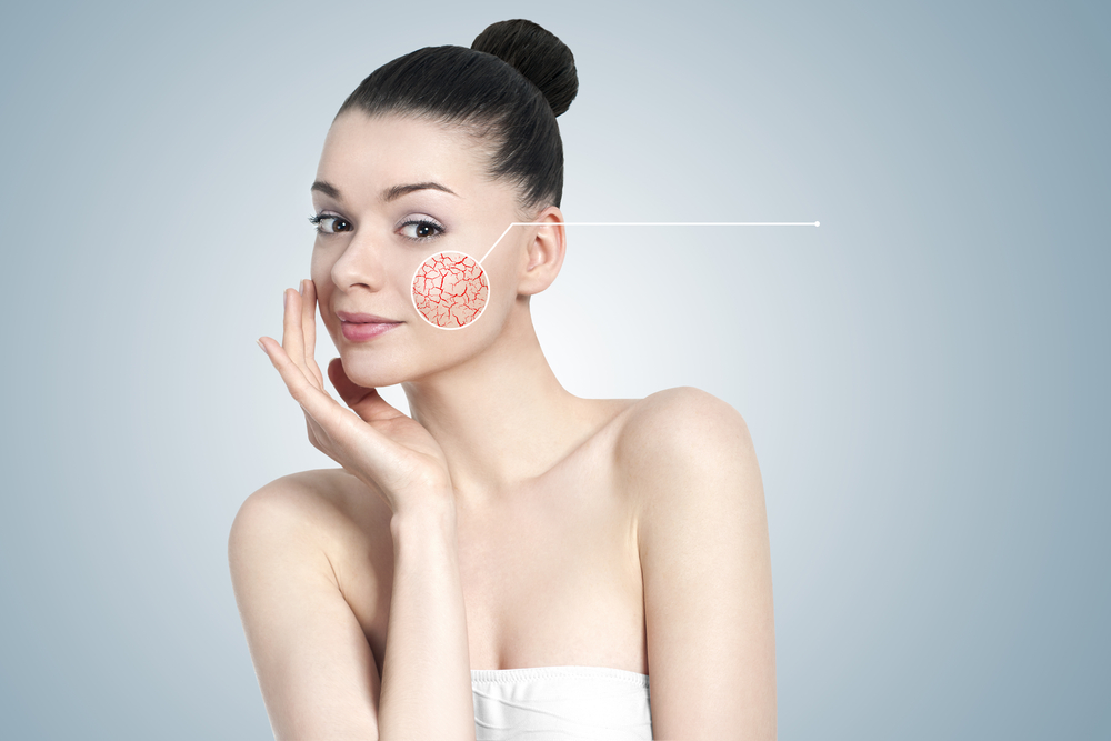 Opting For Home Solutions To Avoid Scar Removal Treatment